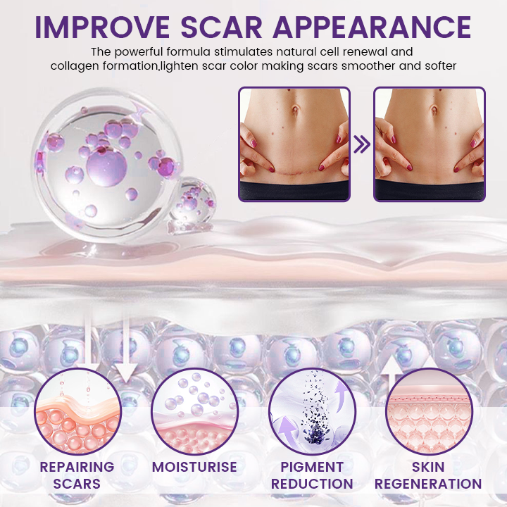 TOCLVO® ReGenScar Stem Cell Scar Gel