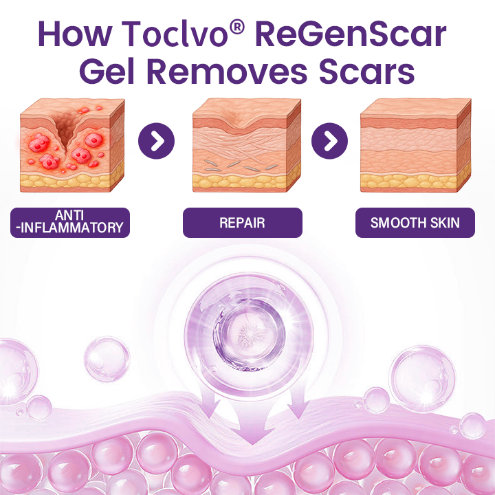 TOCLVO® ReGenScar Stem Cell Scar Gel