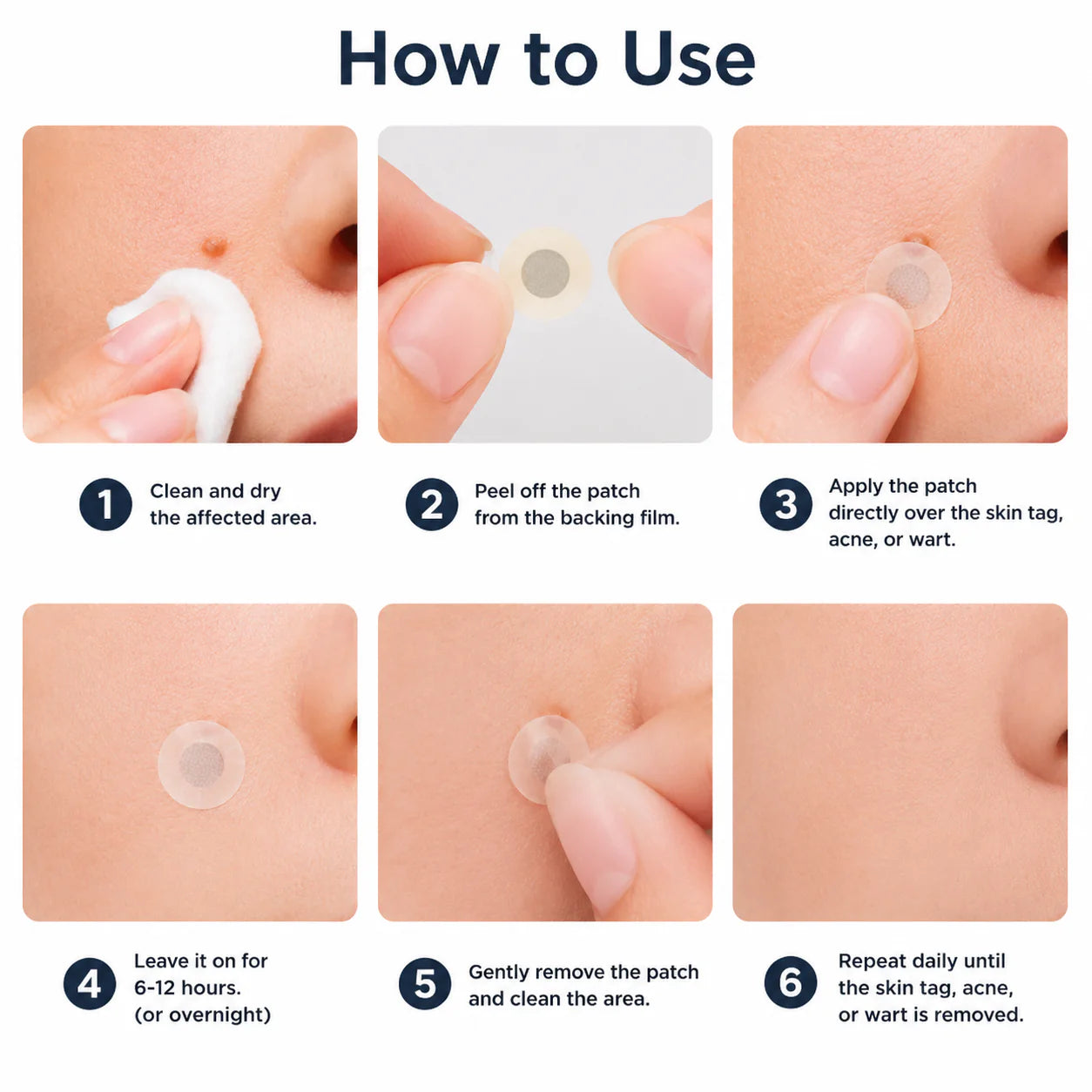💦✨2-in-1 Microneedle & Hydrocolloid Patch🍀| Removes Raised Moles, Acne, Flat Warts & Skin Tags | Helps Improve Wrinkles, Scars & Blemishes | Invisible Patches for Face & Body