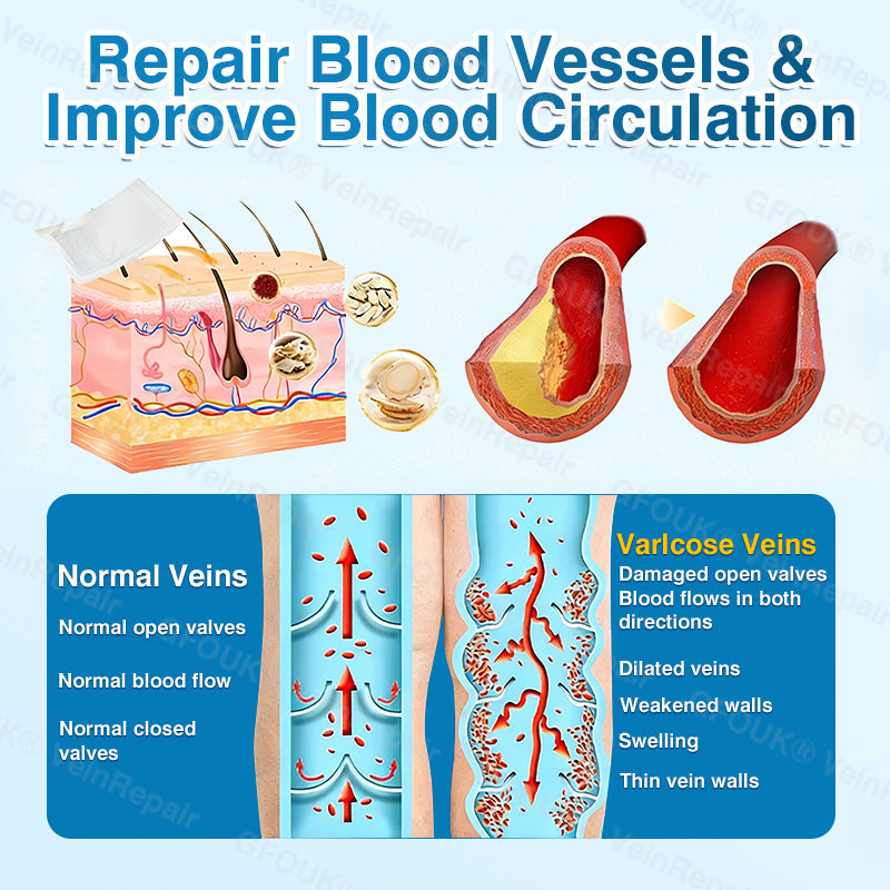 🇺🇸🏅🛡️GFOUK® VeinRepair Microneedle Patch Roll⚡Instant Relief, Long-Term Results