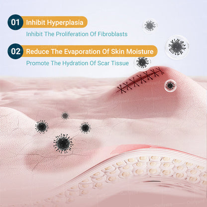 💧✅ Official Store | Ourlyard® Hyaluronic Acid Nano Microneedle Scar Repair Tape 🗽🎉 (Helps improve the appearance of surgical scars, old scars, and raised scars)
