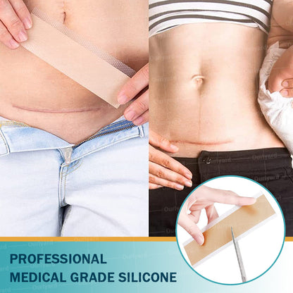 💧✅ Official Store | Ourlyard® Hyaluronic Acid Nano Microneedle Scar Repair Tape 🗽🎉 (Helps improve the appearance of surgical scars, old scars, and raised scars)