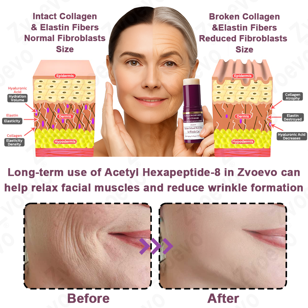 💧🥂 Official Store: Zvoevo® Calcium Collagen Repair Lip Balm 👩‍⚕️ TGA Certified (For wrinkles and fine lines, smoothing nasolabial folds and neck lines, softening crow's feet)