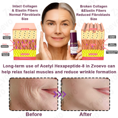 💧🥂 Official Store: Zvoevo® Calcium Collagen Repair Lip Balm 👩‍⚕️ TGA Certified (For wrinkles and fine lines, smoothing nasolabial folds and neck lines, softening crow's feet)