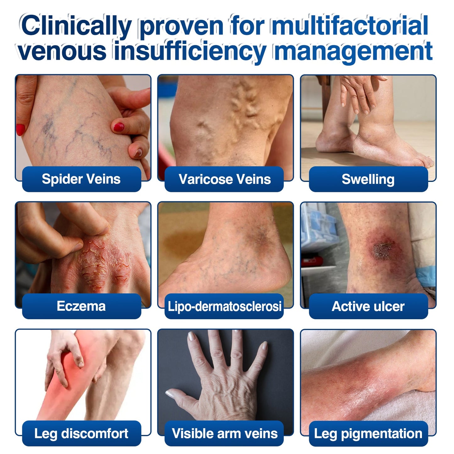 🛡️🦵GFOUK® VeinRenew Microneedle Balm