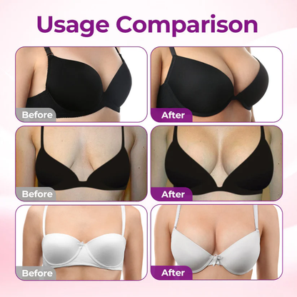 💧💥Turonu® 👩‍⚕️ Targeted Breast Enhancement Advanced Nano Microneedle Patch💃