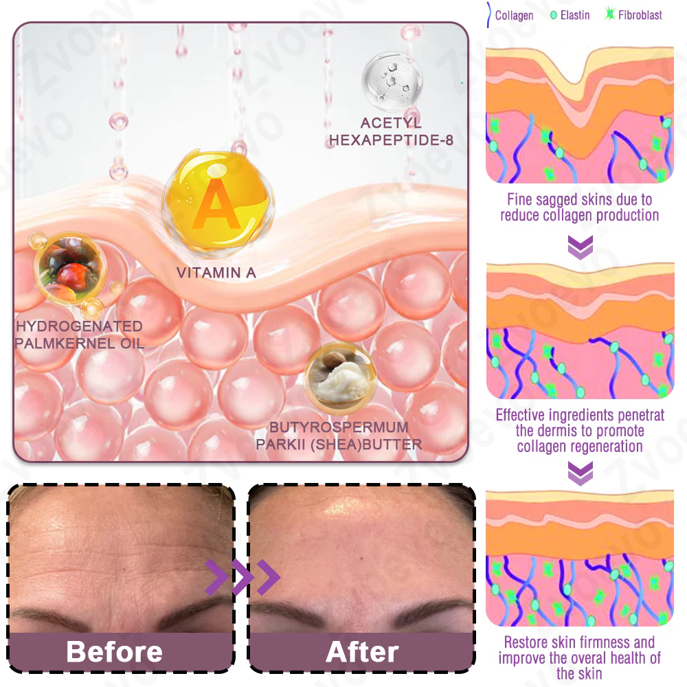 💧🥂 Official Store: Zvoevo® Calcium Collagen Repair Lip Balm 👩‍⚕️ TGA Certified (For wrinkles and fine lines, smoothing nasolabial folds and neck lines, softening crow's feet)