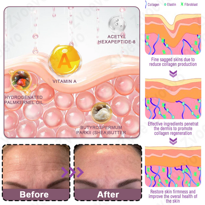 💧🥂 Official Store: Zvoevo® Calcium Collagen Repair Lip Balm 👩‍⚕️ TGA Certified (For wrinkles and fine lines, smoothing nasolabial folds and neck lines, softening crow's feet)