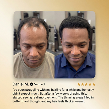 💦🎀HUDROS® Advanced Batana Hair Regrowth Therapy 🔥 50% OFF
