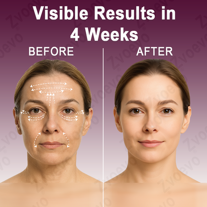 💧🥂 Official Store: Zvoevo® Calcium Collagen Repair Lip Balm 👩‍⚕️ TGA Certified (For wrinkles and fine lines, smoothing nasolabial folds and neck lines, softening crow's feet)