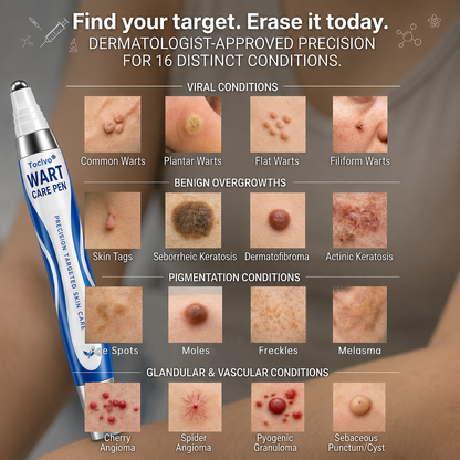 💧✨ Toclvo® Fast-Acting Wart Remover Care Pen | Targets Warts, Skin Tags & Rough Bumps
