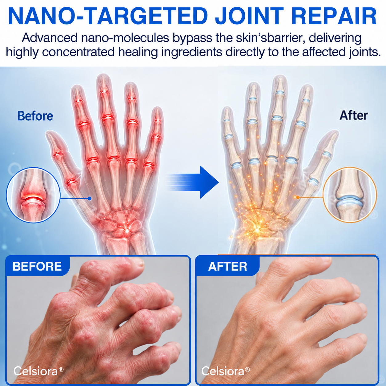 💧✅ Celsiora® Pain-Relief Bone-Healing Microneedle Patch(🧑‍⚕️Reducing joint swelling, pain, stiffness, redness, warmth, soreness, and joint fatigue)