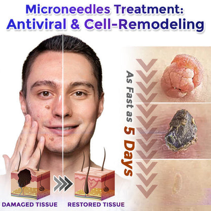 💧☘️Celsiora® Multi-Functional Microneedle Hydrocolloid Patch Roll | Targets Skin Tags, Warts & Stubborn Blemishes
