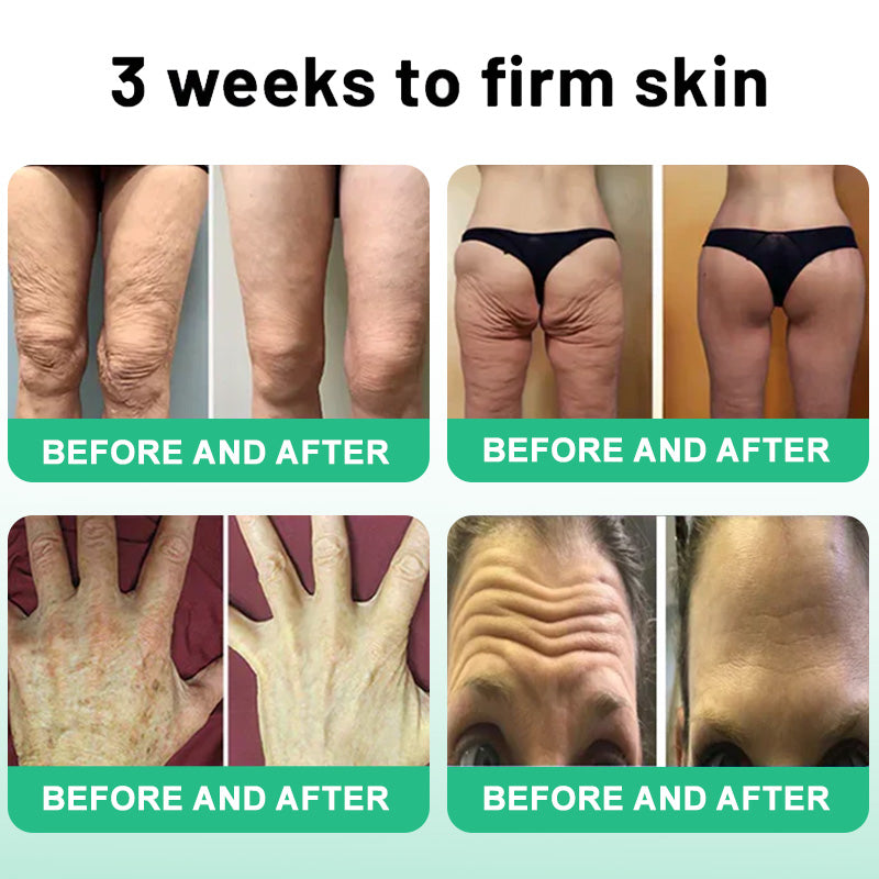 💧🔥66% OFF Ends Soon! Pheromex® Firming & Glow Oil — Hydrate, Smooth & Restore Radiant, Youthful-Looking Skin