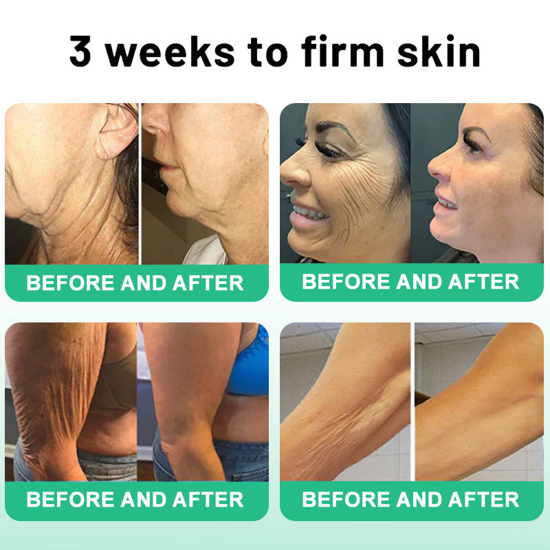 💧🔥66% OFF Ends Soon! Pheromex® Firming & Glow Oil — Hydrate, Smooth & Restore Radiant, Youthful-Looking Skin