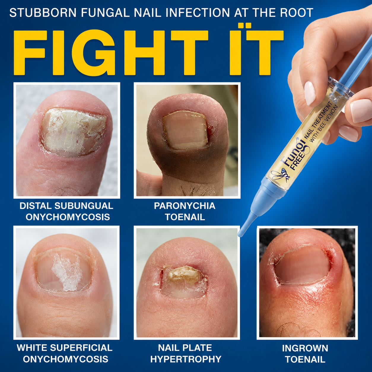 💧🔥 Celsiora® Fungal Nail Treatment | Bee Venom Formula | Gentle At-Home Nail Care