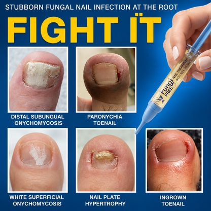💧🔥 Celsiora® Fungal Nail Treatment | Bee Venom Formula | Gentle At-Home Nail Care