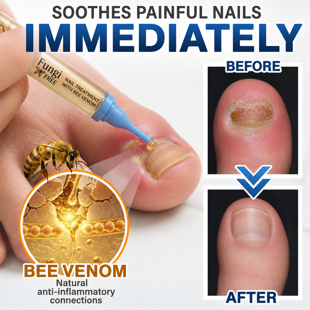 💧🔥 Celsiora® Fungal Nail Treatment | Bee Venom Formula | Gentle At-Home Nail Care