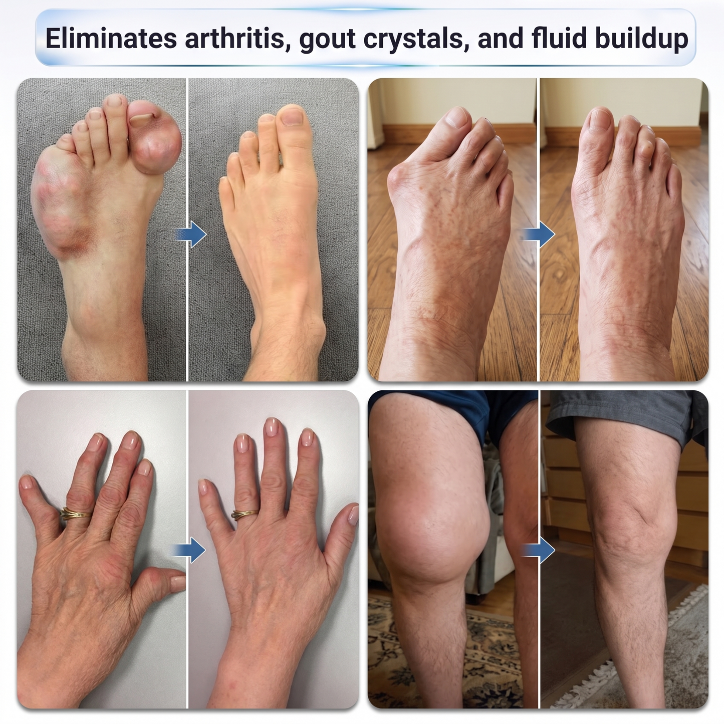 💧✅ LUCKYSONG® Fast-Acting Joint & Bone Relief Roll-On (🧑‍⚕️ Helps relieve joint pain, swelling, stiffness, soreness, warmth & everyday joint fatigue)