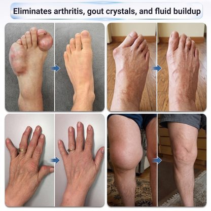💧✅ LUCKYSONG® Fast-Acting Joint & Bone Relief Roll-On (🧑‍⚕️ Helps relieve joint pain, swelling, stiffness, soreness, warmth & everyday joint fatigue)